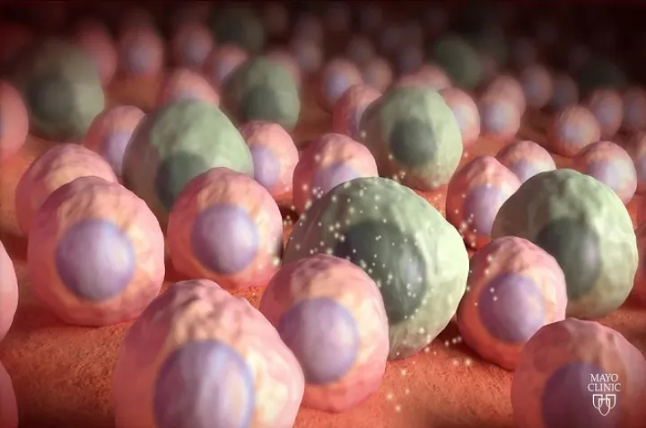 جلوگیری از پیر شدن سلول‌ها راهی برای مقابله با سرطان