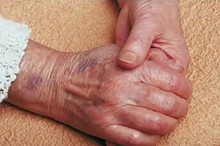 کبک از نظر موارد مرگ آسان در کانادا جایگاه اول را دارد